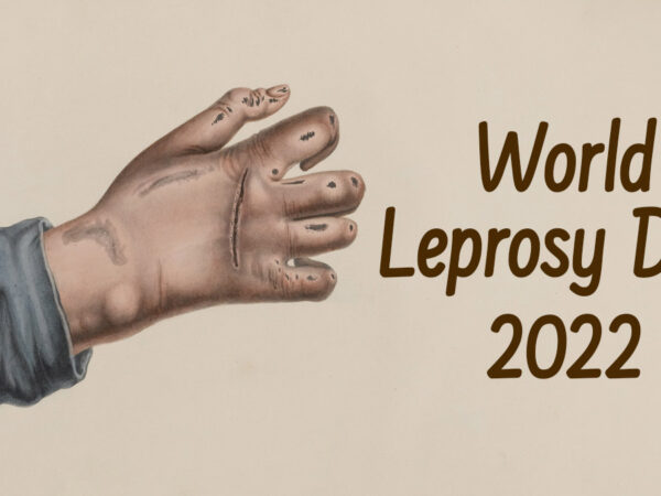 कुष्ठरोग