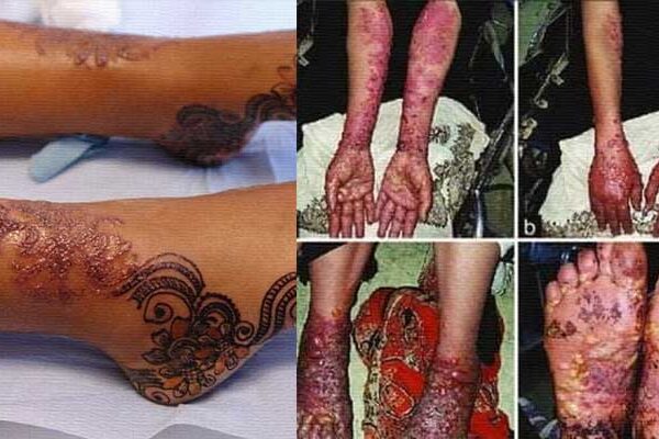 Mehendi news photo