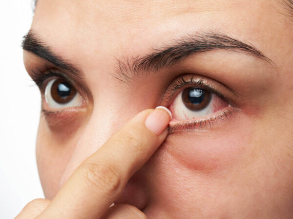 Eye